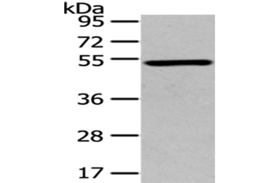 TSPYL1 Antibody from Signalway Antibody (43171) - Antibodies.com
