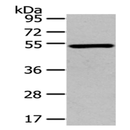 TSPYL1 Antibody from Signalway Antibody (43171) - Antibodies.com