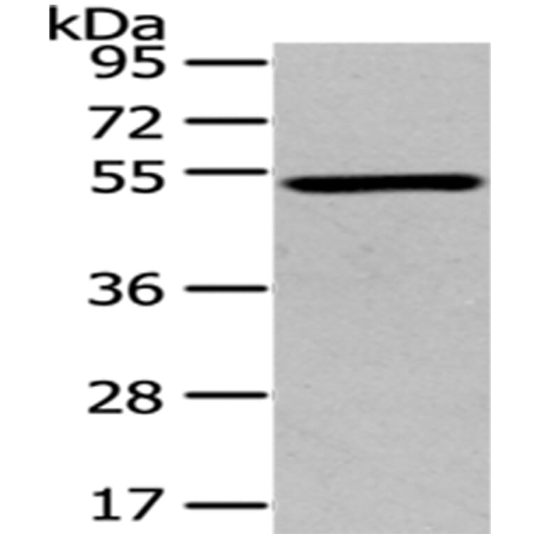 TSPYL1 Antibody from Signalway Antibody (43171) - Antibodies.com