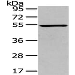 TSPYL1 Antibody from Signalway Antibody (43171) - Antibodies.com