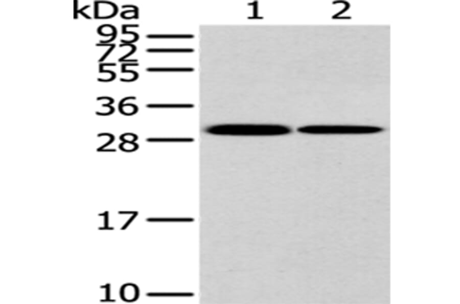 HNRNPC Antibody from Signalway Antibody (43187) - Antibodies.com