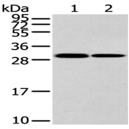 HNRNPC Antibody from Signalway Antibody (43187) - Antibodies.com