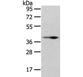 WNT10B Antibody from Signalway Antibody (43195) - Antibodies.com
