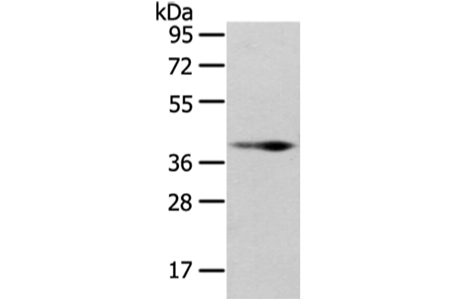WNT10B Antibody from Signalway Antibody (43195) - Antibodies.com