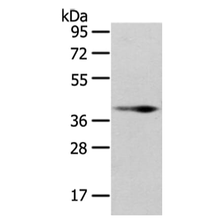 WNT10B Antibody from Signalway Antibody (43195) - Antibodies.com