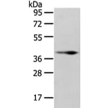 WNT10B Antibody from Signalway Antibody (43195) - Antibodies.com