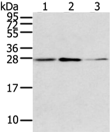 Gel: 12% SDS-PAGE Lysate: 40 &#956;g Lane 1-3: K562, 231 and PC3 cell Primary antibody: 1/200 dilution Secondary antibody: Goat anti rabbit IgG at 1/8000 dilution Exposure time: 1 minute