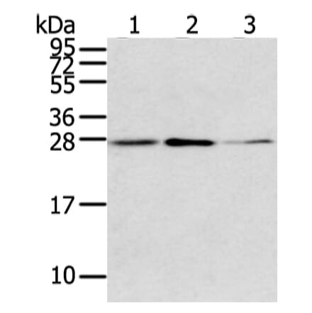 CLDN15 Antibody from Signalway Antibody (43237) - Antibodies.com