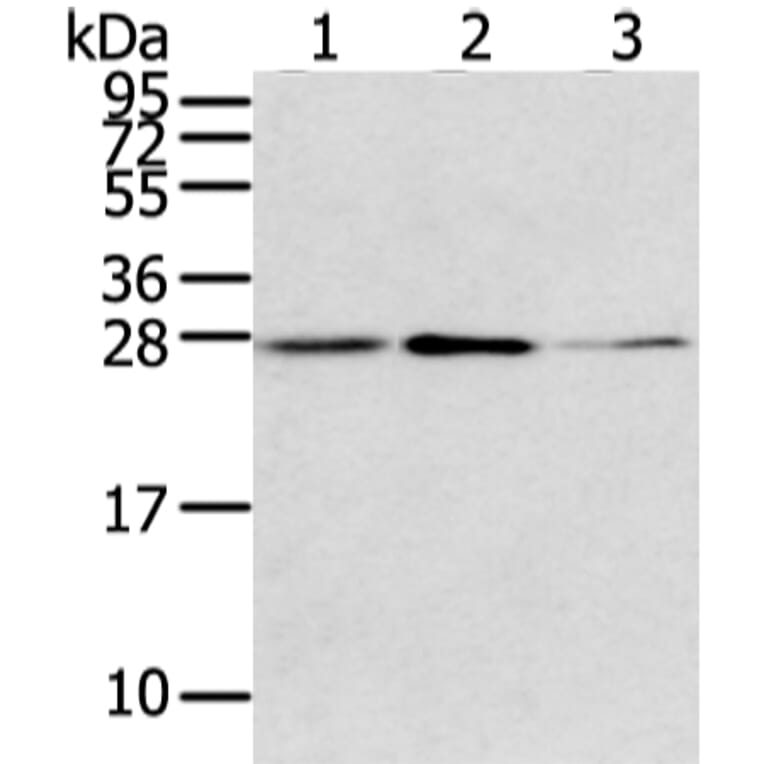 CLDN15 Antibody from Signalway Antibody (43237) - Antibodies.com