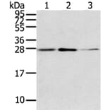 CLDN15 Antibody from Signalway Antibody (43237) - Antibodies.com