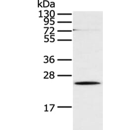 CLDN18 Antibody from Signalway Antibody (43253) - Antibodies.com