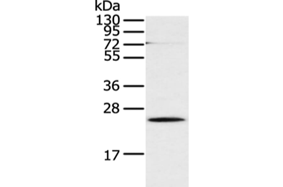 CLDN18 Antibody from Signalway Antibody (43253) - Antibodies.com