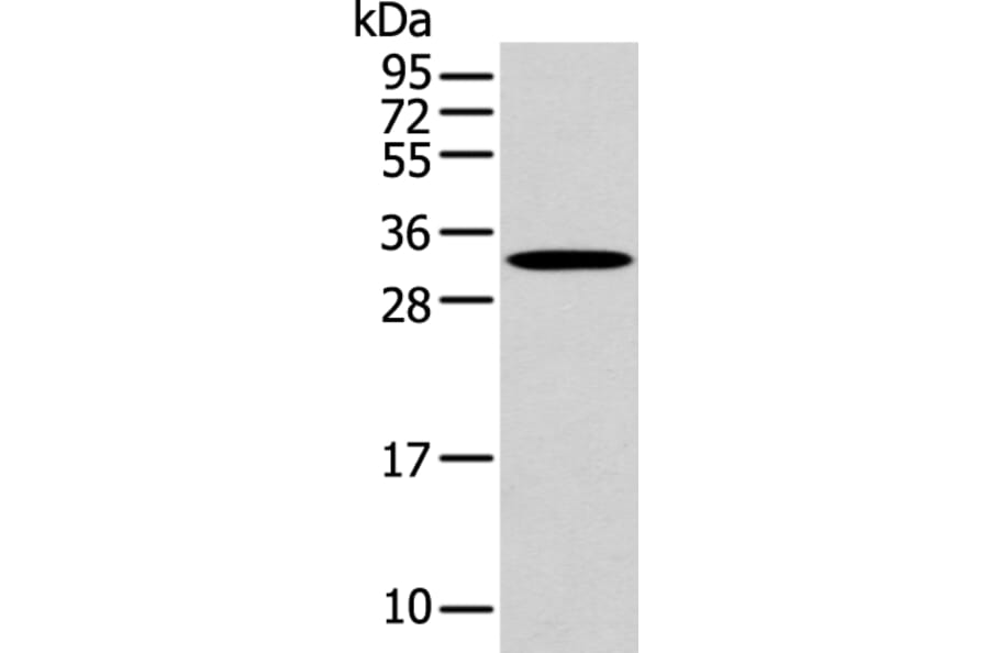 NANOS1 Antibody from Signalway Antibody (43311) - Antibodies.com