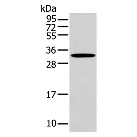 NANOS1 Antibody from Signalway Antibody (43311) - Antibodies.com