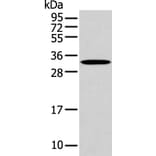 NANOS1 Antibody from Signalway Antibody (43311) - Antibodies.com