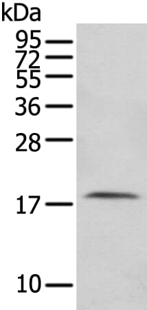 Gel: 12% SDS-PAGE Lysate: 40 &#956;g Lane: Human fetal intestines tissue Primary antibody: 1/200 dilution Secondary antibody: Goat anti rabbit IgG at 1/8000 dilution Exposure time: 30 seconds