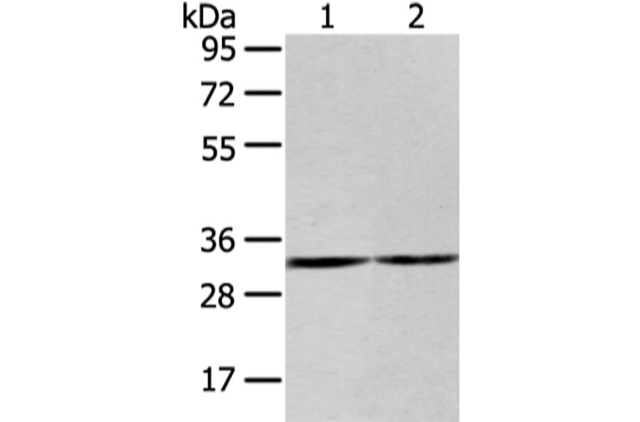 ZNF146 Antibody from Signalway Antibody (43442) - Antibodies.com