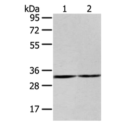 ZNF146 Antibody from Signalway Antibody (43442) - Antibodies.com
