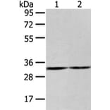 ZNF146 Antibody from Signalway Antibody (43442) - Antibodies.com