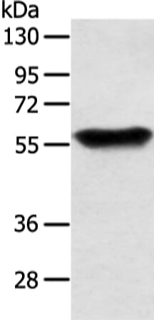 Gel: 6%SDS-PAGE Lysate: 40 &#956;g Lane: Human fetal brain tissue Primary antibody: 1/350 dilution Secondary antibody: Goat anti rabbit IgG at 1/8000 dilution Exposure time: 20 seconds
