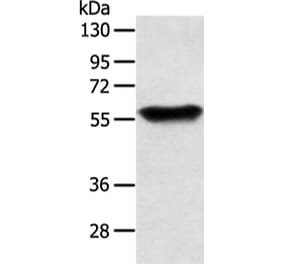 SLC1A3 Antibody from Signalway Antibody (43457) - Antibodies.com