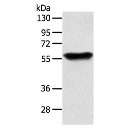 SLC1A3 Antibody from Signalway Antibody (43457) - Antibodies.com