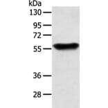 SLC1A3 Antibody from Signalway Antibody (43457) - Antibodies.com
