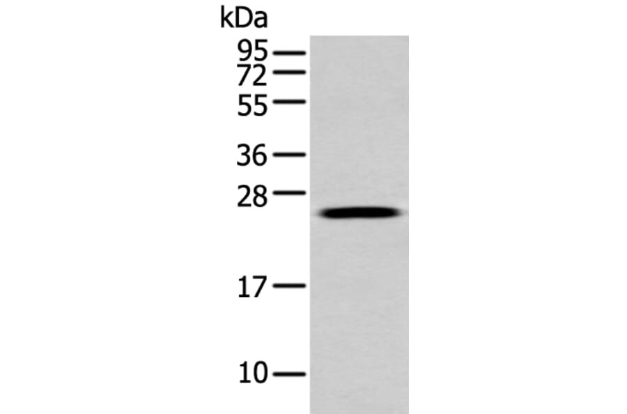 FGFBP1 Antibody from Signalway Antibody (43473) - Antibodies.com