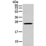 FGFBP1 Antibody from Signalway Antibody (43473) - Antibodies.com