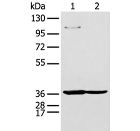 NUDT19 Antibody from Signalway Antibody (43475) - Antibodies.com