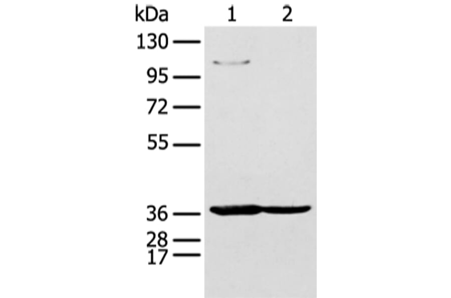 NUDT19 Antibody from Signalway Antibody (43475) - Antibodies.com