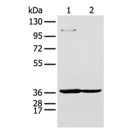 NUDT19 Antibody from Signalway Antibody (43475) - Antibodies.com