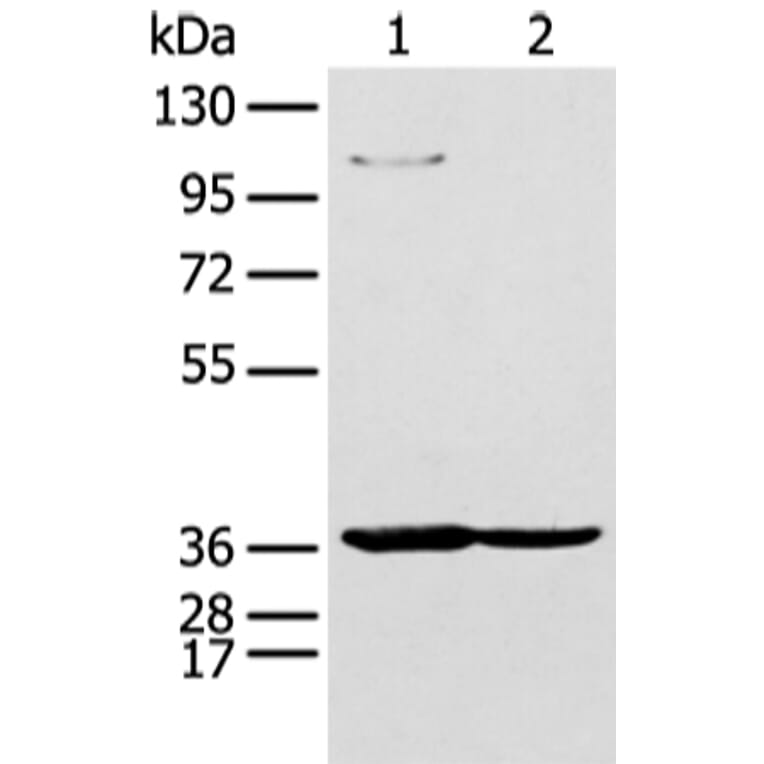 NUDT19 Antibody from Signalway Antibody (43475) - Antibodies.com