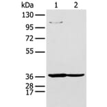 NUDT19 Antibody from Signalway Antibody (43475) - Antibodies.com
