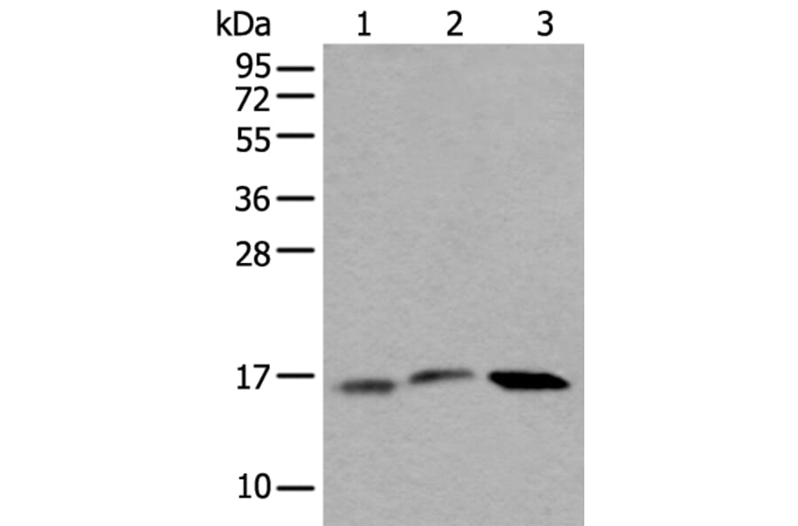 UBE2G2 Antibody from Signalway Antibody (43606) - Antibodies.com
