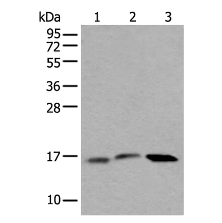 UBE2G2 Antibody from Signalway Antibody (43606) - Antibodies.com