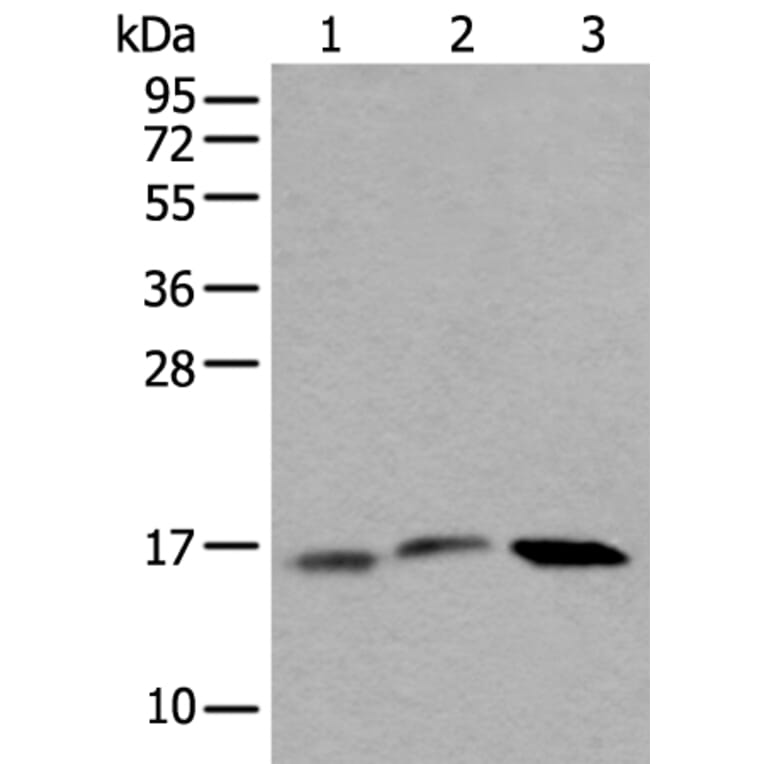 UBE2G2 Antibody from Signalway Antibody (43606) - Antibodies.com