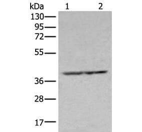 NUDT19 Antibody from Signalway Antibody (43670) - Antibodies.com
