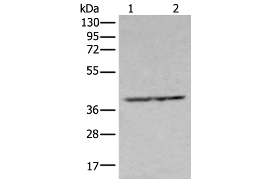 NUDT19 Antibody from Signalway Antibody (43670) - Antibodies.com