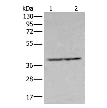 NUDT19 Antibody from Signalway Antibody (43670) - Antibodies.com