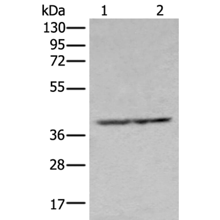 NUDT19 Antibody from Signalway Antibody (43670) - Antibodies.com