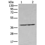 NUDT19 Antibody from Signalway Antibody (43670) - Antibodies.com