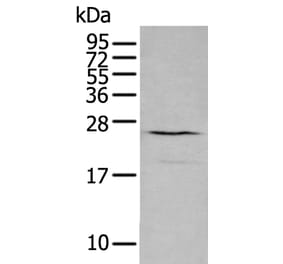 CXCL16 Antibody from Signalway Antibody (43729) - Antibodies.com