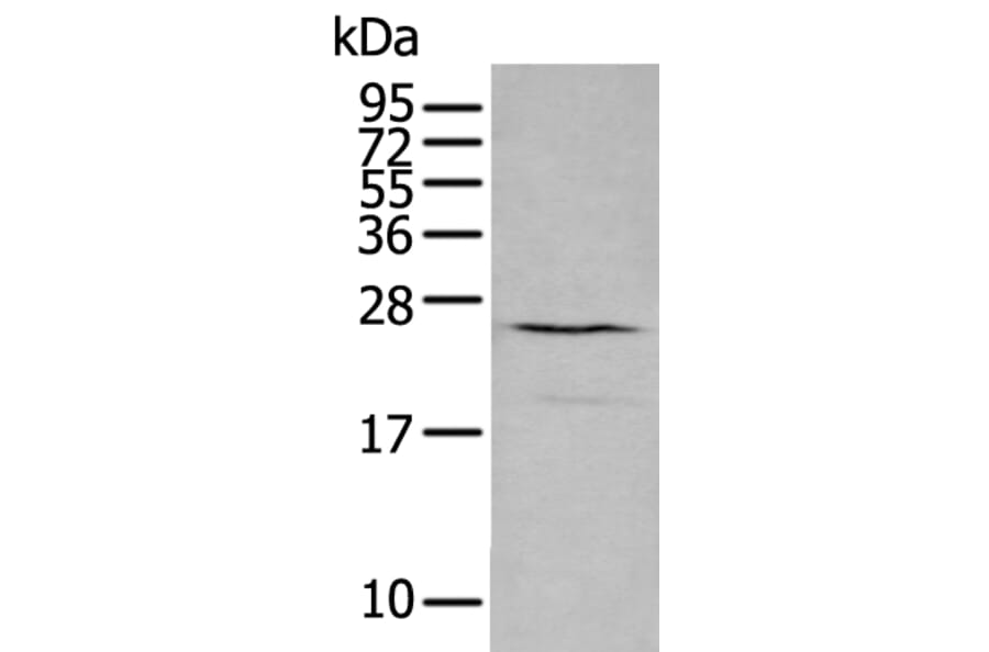 CXCL16 Antibody from Signalway Antibody (43729) - Antibodies.com