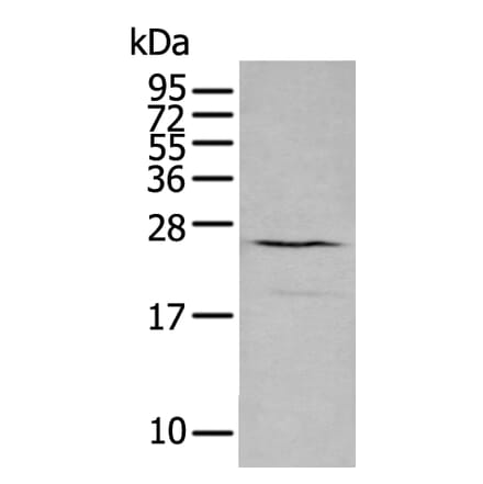 CXCL16 Antibody from Signalway Antibody (43729) - Antibodies.com