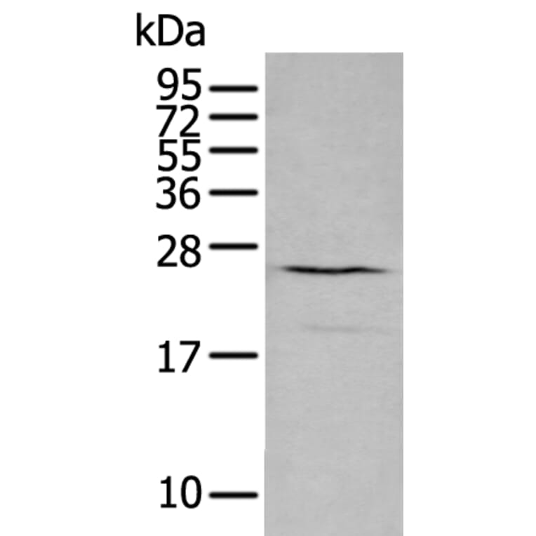CXCL16 Antibody from Signalway Antibody (43729) - Antibodies.com