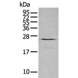 CXCL16 Antibody from Signalway Antibody (43729) - Antibodies.com