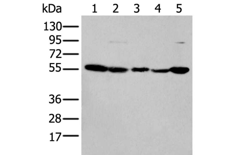 PFKFB3 Antibody from Signalway Antibody (43773) - Antibodies.com
