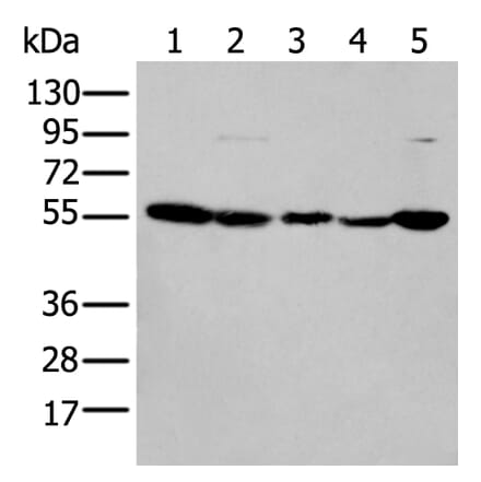 PFKFB3 Antibody from Signalway Antibody (43773) - Antibodies.com