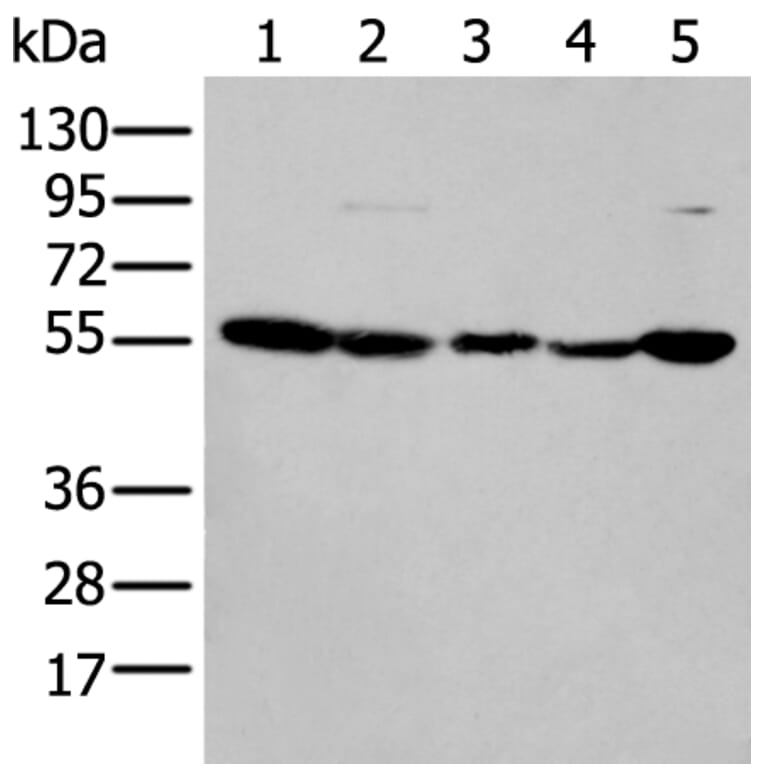 PFKFB3 Antibody from Signalway Antibody (43773) - Antibodies.com